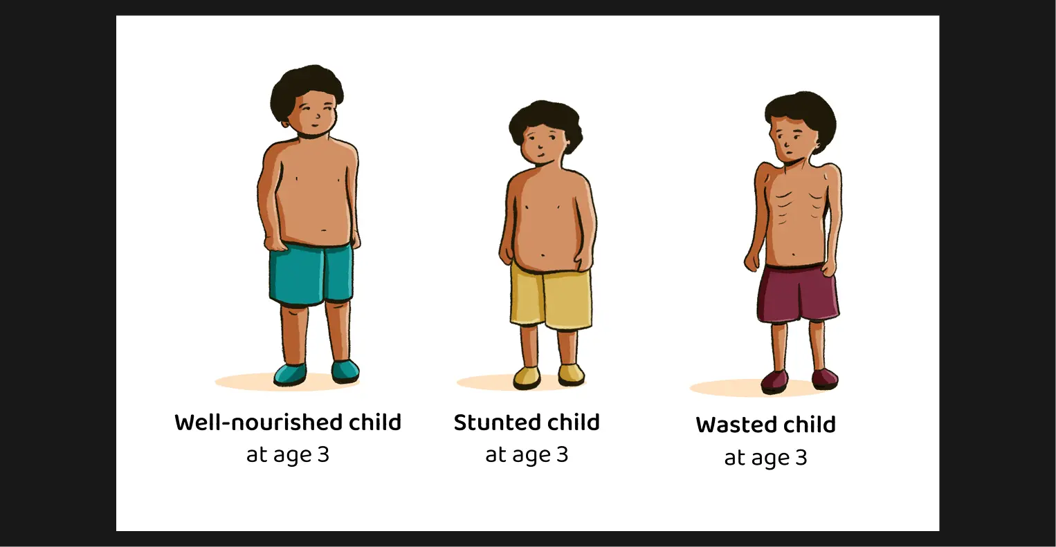Visual Explainer: Physical signs of malnutrition
